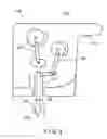 Fig. 04 - METHOD AND APPARATUS FOR SUBSURFACE TISSUE SAMPLING