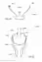 Fig. 33 - Methods and apparatus for rehabilitation and training