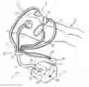 Fig. 01 - APPARATUS AND METHOD OF BODY CONTOURING AND SKIN CONDITIONING
