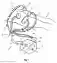 Fig. 02 - APPARATUS AND METHOD OF BODY CONTOURING AND SKIN CONDITIONING