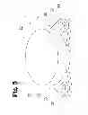 Fig. 06 - Analgesic implant device and system