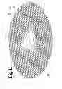 Fig. 12 - Analgesic implant device and system