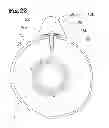 Fig. 23 - Analgesic implant device and system