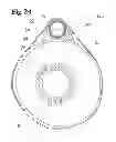 Fig. 25 - Analgesic implant device and system