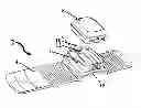 Fig. 01 - System for performing remote ischemic conditioning