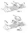 Fig. 02 - System for performing remote ischemic conditioning