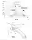 Fig. 03 - Automatic devices for remote ischemic preconditioning