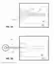 Fig. 07 - Automatic devices for remote ischemic preconditioning