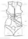Fig. 01 - Orthotic device and method of making an orthotic device