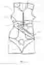 Fig. 02 - Orthotic device and method of making an orthotic device