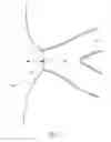Fig. 03 - Orthotic device and method of making an orthotic device
