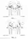 Fig. 04 - Orthotic device and method of making an orthotic device