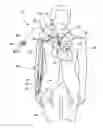 Fig. 01 - System and method to increase the overall diameter of veins and arteries
