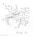 Fig. 04 - System and method to increase the overall diameter of veins and arteries