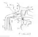 Fig. 07 - System and method to increase the overall diameter of veins and arteries