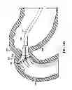 Fig. 06 - Removal and repositioning devices