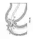 Fig. 07 - Removal and repositioning devices