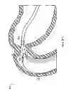Fig. 08 - Removal and repositioning devices