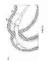 Fig. 09 - Removal and repositioning devices