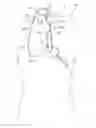 Fig. 01 - Methods and Systems for Establishing Retrograde Carotid Arterial Blood Flow