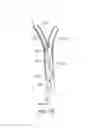 Fig. 06 - Methods and Systems for Establishing Retrograde Carotid Arterial Blood Flow