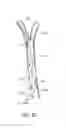 Fig. 08 - Methods and Systems for Establishing Retrograde Carotid Arterial Blood Flow