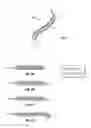 Fig. 02 - SHAPE-TRANSFERRING CANNULA SYSTEM AND METHOD OF USE