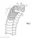 Fig. 03 - SHAPE-TRANSFERRING CANNULA SYSTEM AND METHOD OF USE