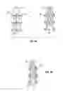 Fig. 04 - SHAPE-TRANSFERRING CANNULA SYSTEM AND METHOD OF USE