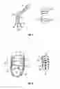 Fig. 05 - SHAPE-TRANSFERRING CANNULA SYSTEM AND METHOD OF USE