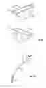 Fig. 20 - SHAPE-TRANSFERRING CANNULA SYSTEM AND METHOD OF USE