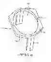 Fig. 09 - Introducer handle notch design/concept
