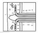 Fig. 01 - Multi-Lumen Needle and Catheter Guidance System