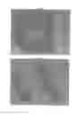 Fig. 07 - Occlusion device for closing anatomical defects