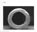 Fig. 03 - Degradable removable implant for the sustained release of an active compound