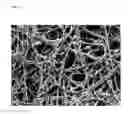 Fig. 04 - Degradable removable implant for the sustained release of an active compound