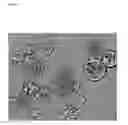 Fig. 06 - Degradable removable implant for the sustained release of an active compound
