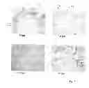 Fig. 07 - Wound contacting members and methods