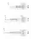 Fig. 07 - PREPARATION PATCH AND SAFETY SYRINGE SYSTEM