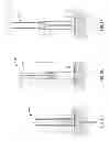 Fig. 08 - PREPARATION PATCH AND SAFETY SYRINGE SYSTEM