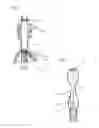 Fig. 07 - TRANS-ANAL INFLOW CATHETER AND METHOD FOR INTERMITTENTLY TRIGGERING A REFLEX-COORDINATED DEFECATION