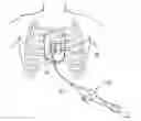 Fig. 01 - Multipolarity epicardial radiofrequency ablation
