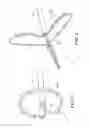 Fig. 03 - Multipolarity epicardial radiofrequency ablation