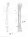 Fig. 02 - Osteosynthesis system for the multidirectional, angular-stable treatment of fractures of tubular bones comprising an intramedullary nail and bone screws