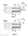 Fig. 09 - Bone end (epiphysis) fracture fixation device and method of use