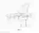 Fig. 09 - Cut guide attachment for use in tibial prosthesis systems
