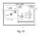 Fig. 06 - Spinal Instrument For Measuring Load and Position Of Load