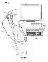 Fig. 02 - Multiple Viewing Elements Endoscope Having Two Front Service Channels