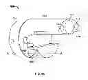 Fig. 09 - Multiple Viewing Elements Endoscope Having Two Front Service Channels