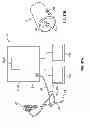 Fig. 166 - Multiple Viewing Elements Endoscope Having Two Front Service Channels